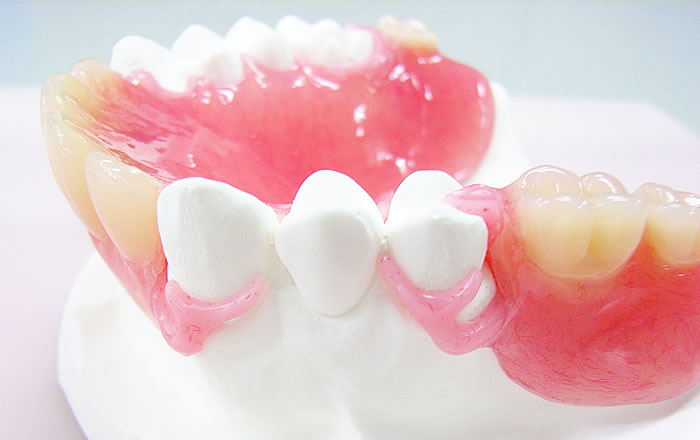 味覚障害の治療で歯科治療が有効な場合：入れ歯の調整