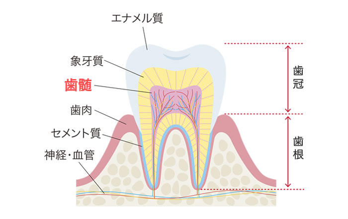 虫歯で顎が痛くなる理由：神経にまで虫歯が達すると痛みを感じるから