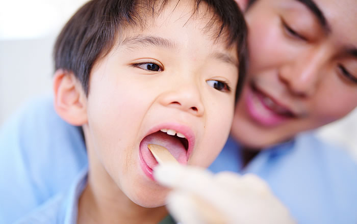 舌小帯付着異常の見分け方：舌先がクサビ型になる