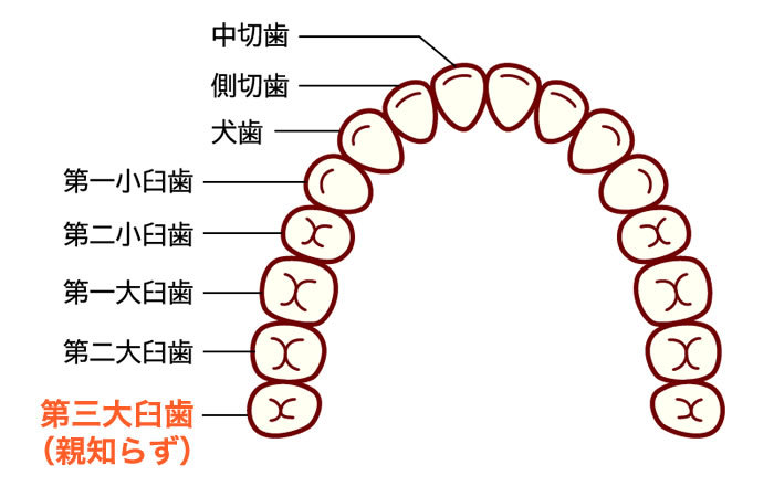 移植のためのドナーとなる歯は親知らず